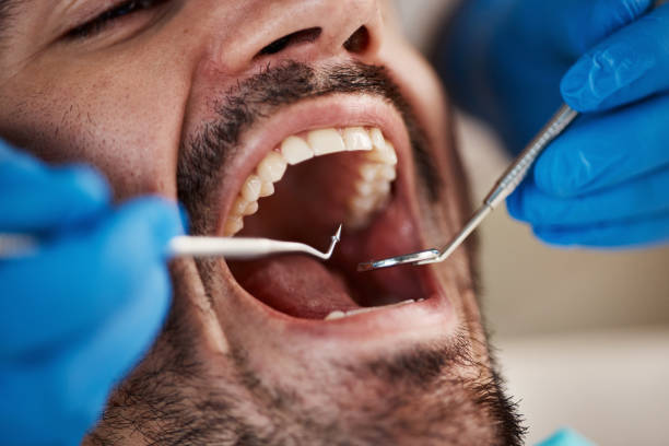 Best Knocked-Out Tooth Emergency  in Weston, FL
